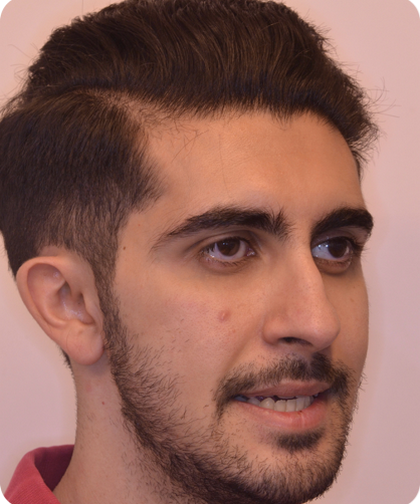 invisible ba case 12.2_2