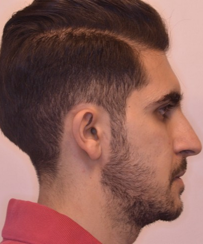 invisible ba case 12.2_4