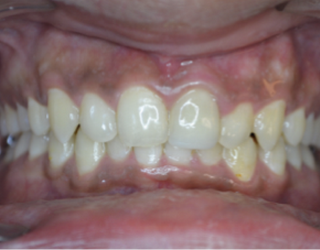 invisible ba case 7_2