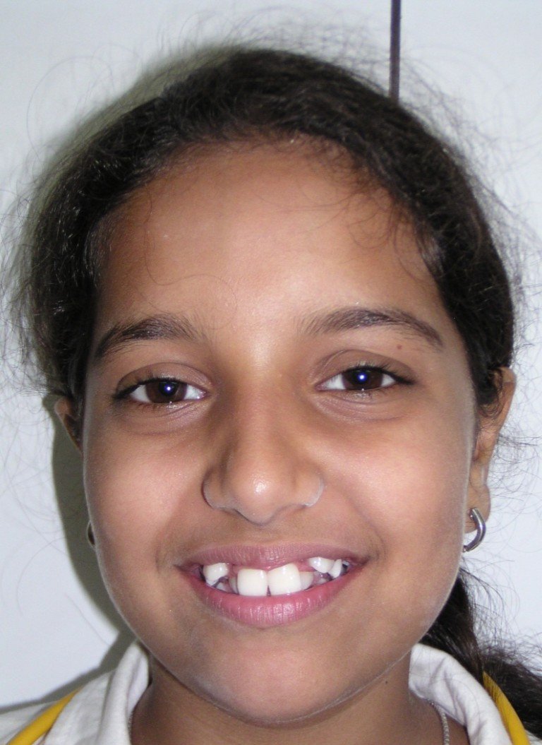 Picture1