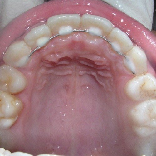 Picture10