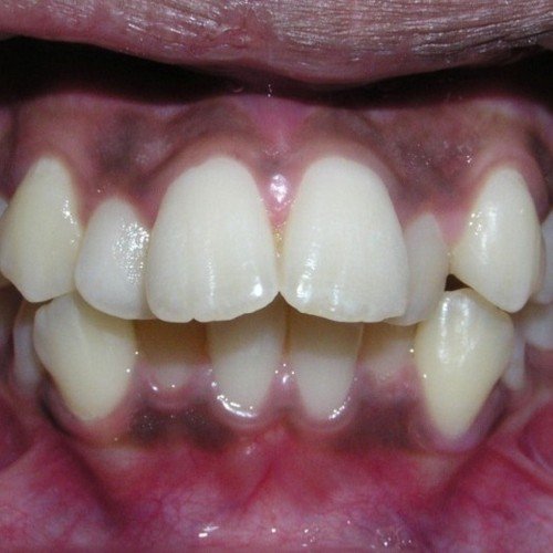Picture14