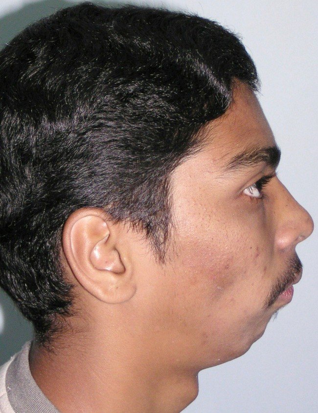Picture33
