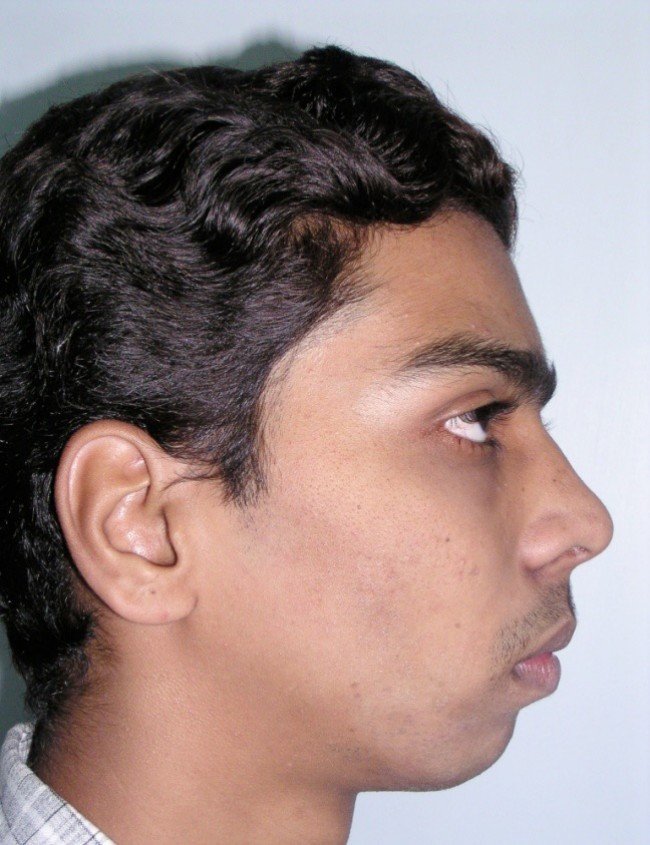 Picture34