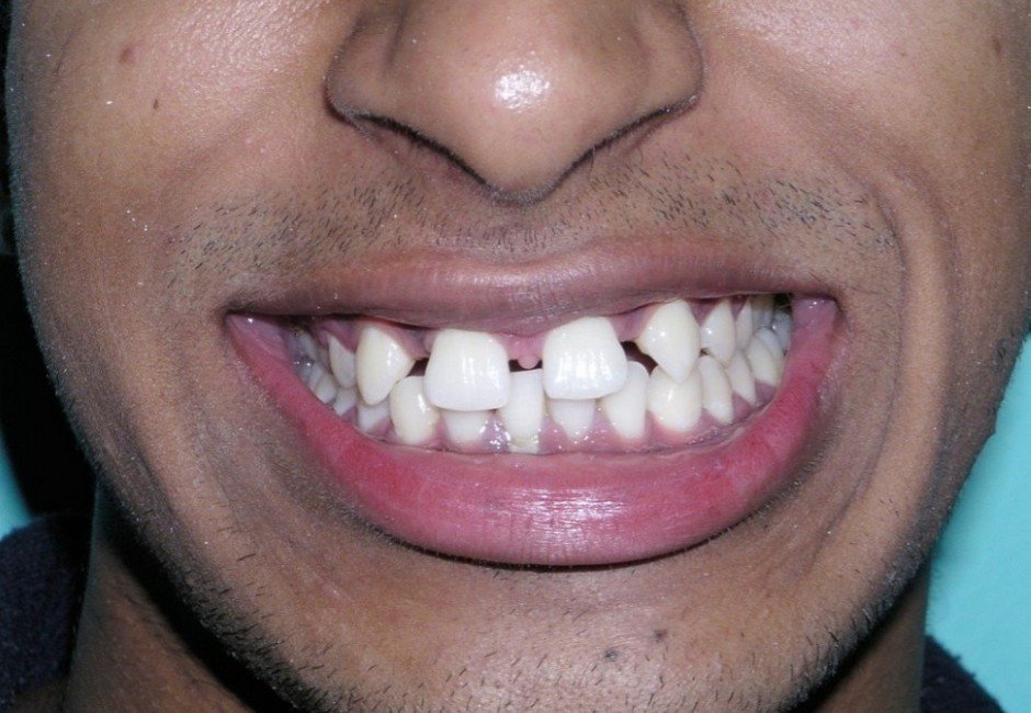 Picture35