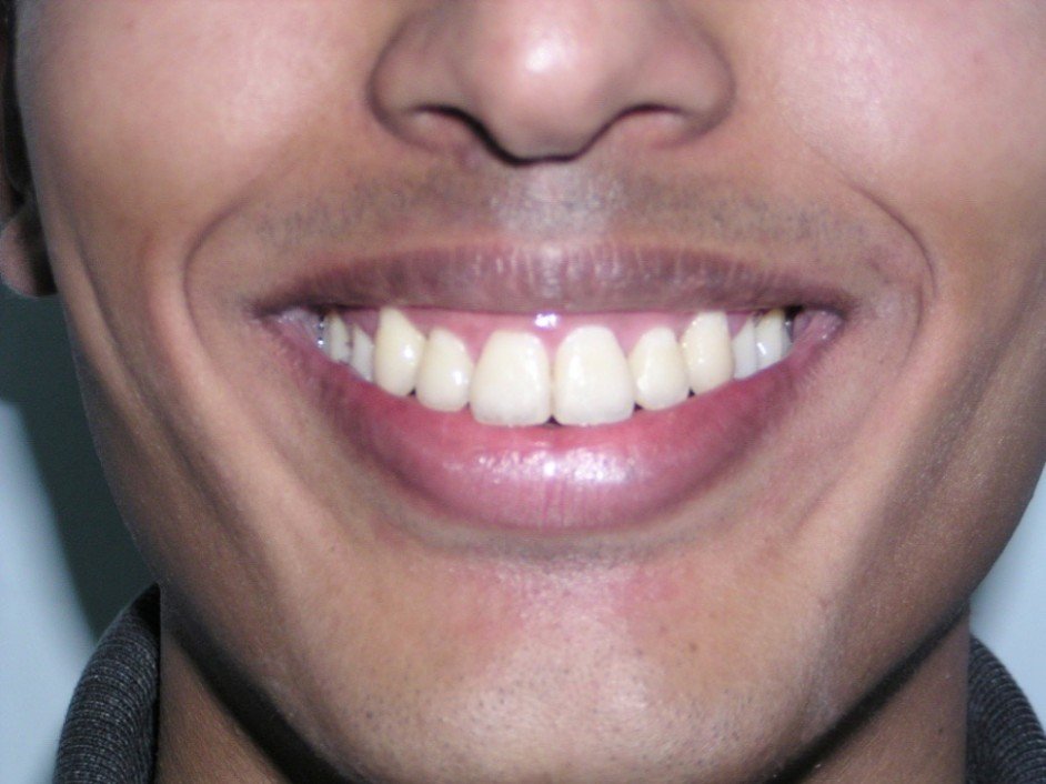 Picture38