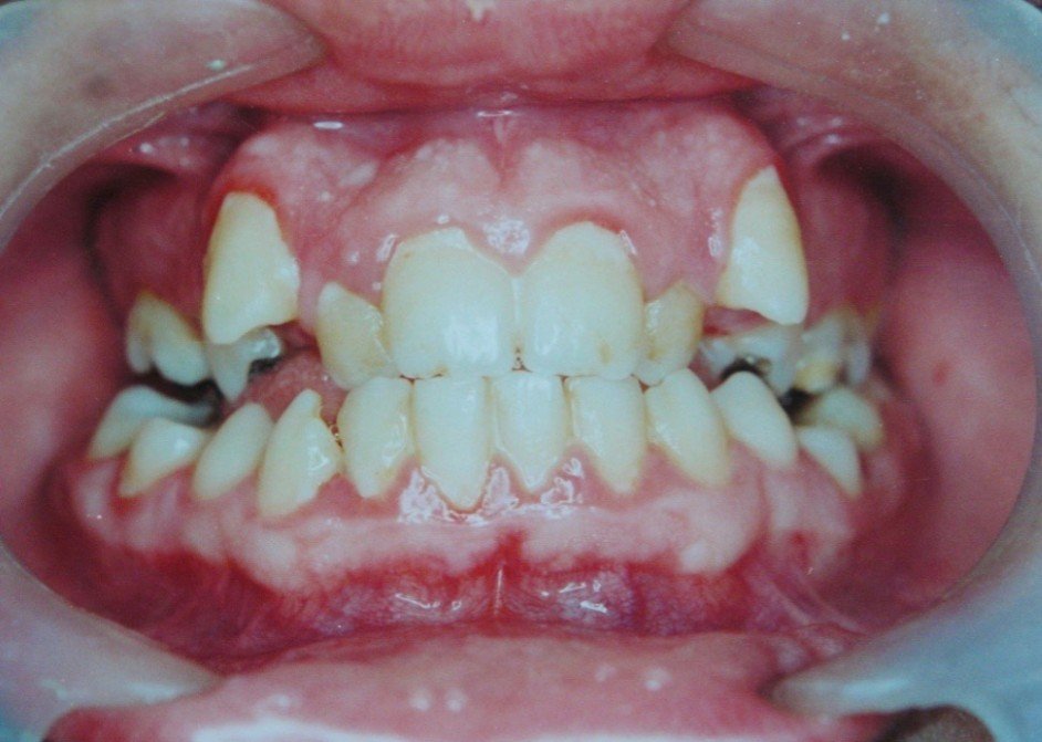 Picture43