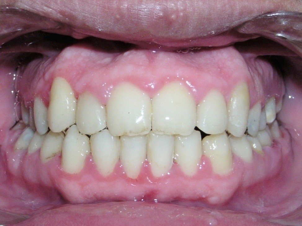 Picture44