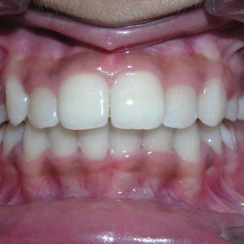 Picture8