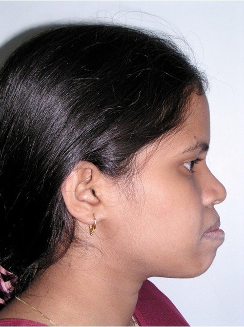 pic1