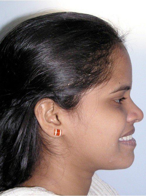 pic2
