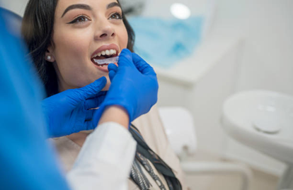 Benefits of SmileAligners