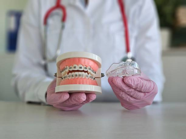 Step-by-Step Process of Smile Designing