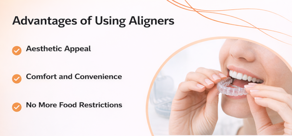 advantages of aligners