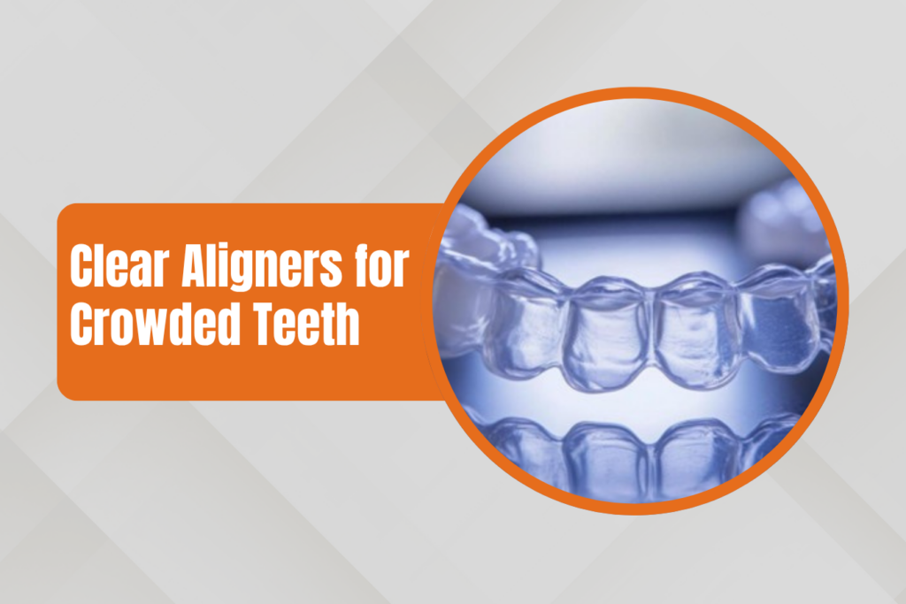 Banner showing 'Clear Aligners for Crowded Teeth' with a circular photo of clear dental aligners.