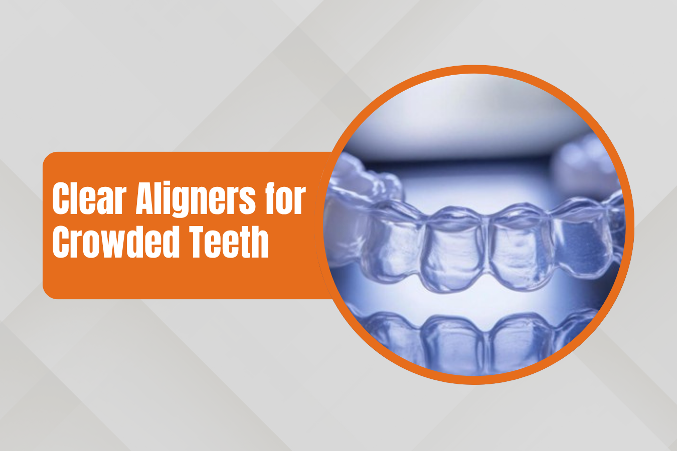 Banner showing 'Clear Aligners for Crowded Teeth' with a circular photo of clear dental aligners.