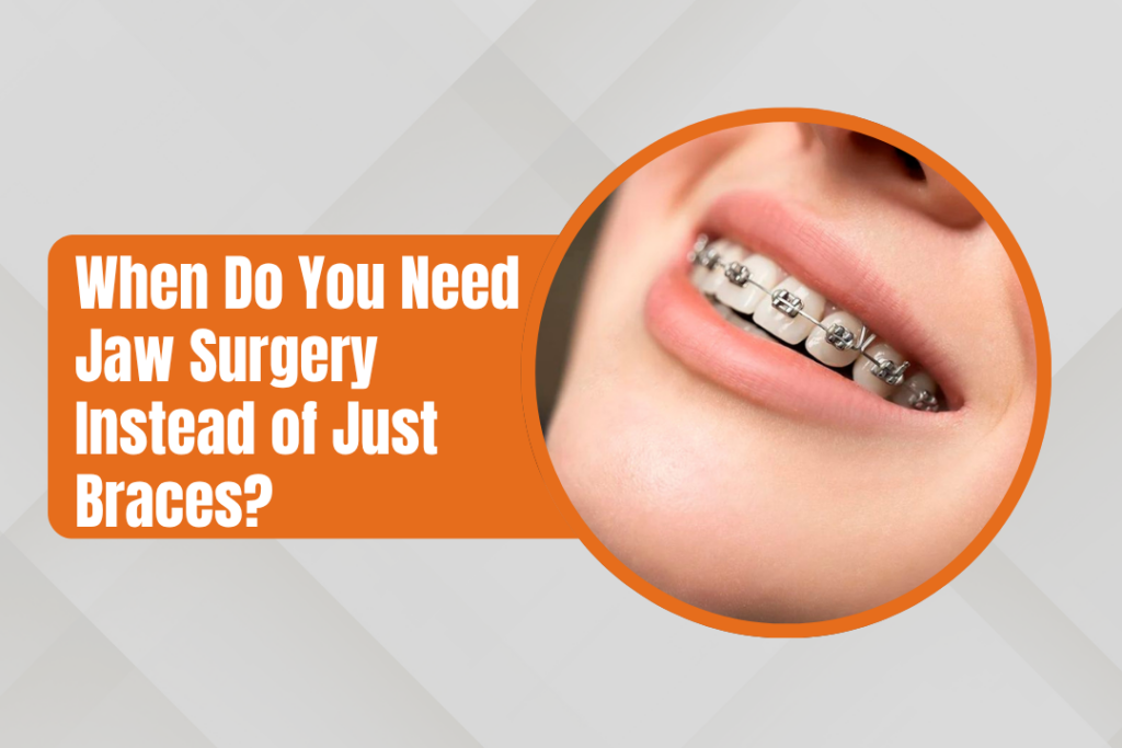 When Do You Need Jaw Surgery Instead of Just Braces?