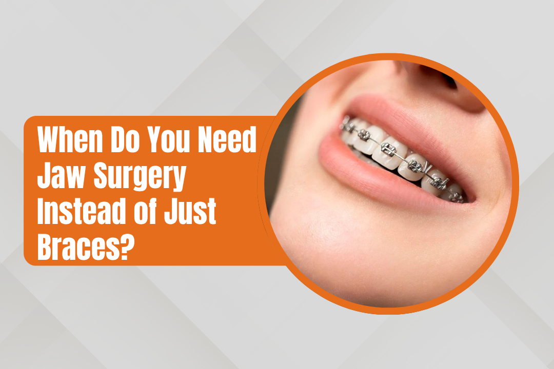 When Do You Need Jaw Surgery Instead of Just Braces?