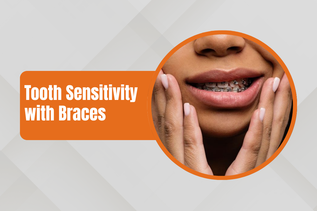 Tooth Sensitivity with Braces