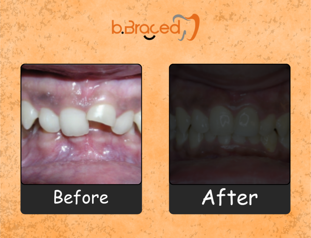 Dr Pravin Shetty orthodontist in Mumbai