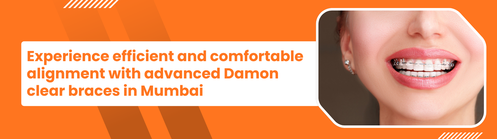 Promotional banner for Damon clear braces in Mumbai, featuring a smiling person with braces on the right and a bold headline on the left.