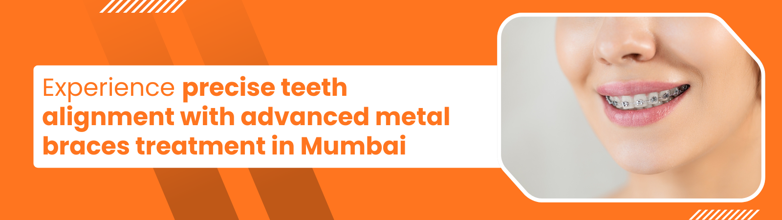Banner promoting metal braces in Mumbai; left-side bold text and a smiling person with braces on the right.