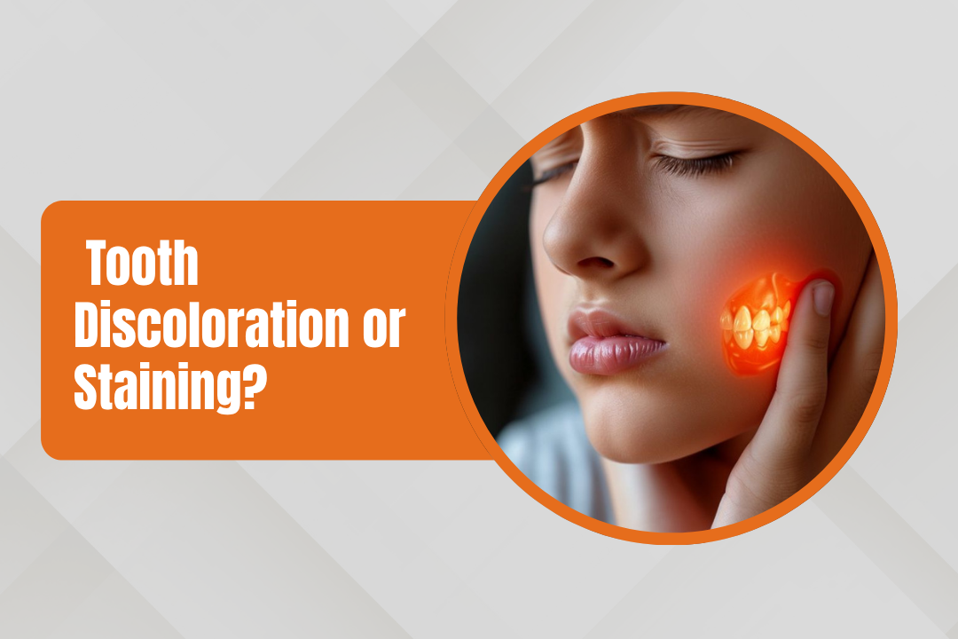 Can Braces Cause Permanent Tooth Discoloration? | Dr. Pravin Shetty
