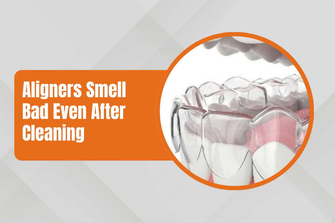 Why Do My Aligners Smell Bad Even After Cleaning?