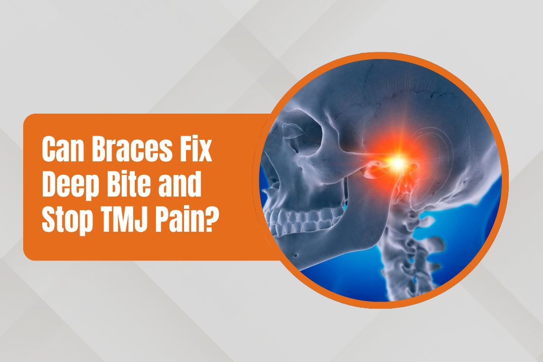Can Braces Fix Deep Bite & TMJ Pain? | Dr. Pravin Shetty