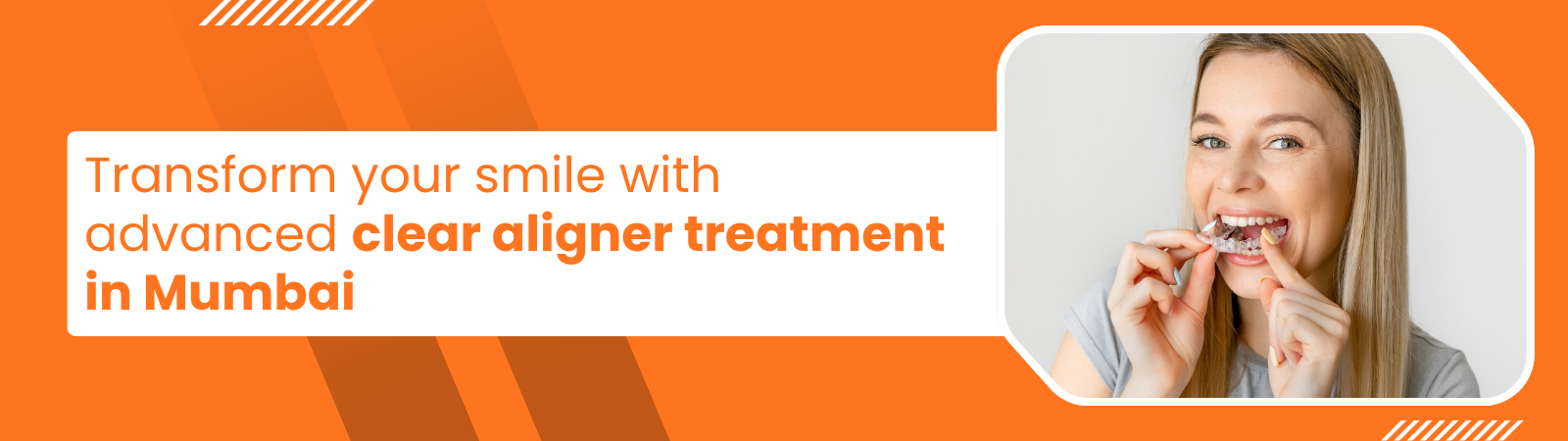 Promotional banner: orange background with text about clear aligner treatment in Mumbai and a woman showing aligners on the right